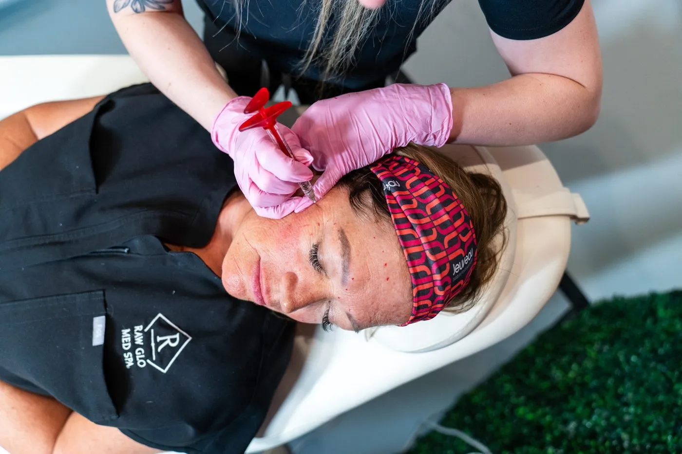 Dermal filler treatment at Raw Glo Med Spa in Waukesha, WI